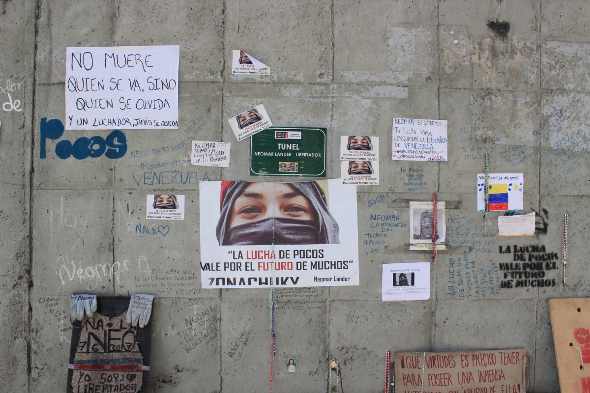 You Can See the Battle&nbsp;Scars